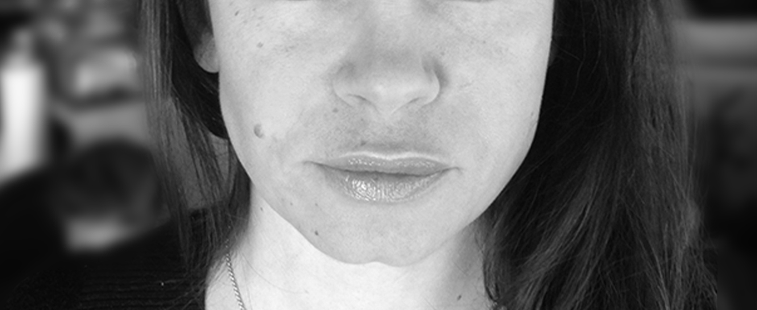 Dr Pellet acide hyaluronique sillons apres